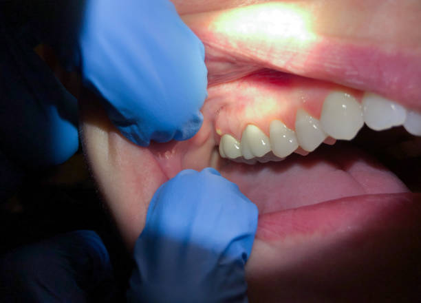 Best Emergency Care for Gum Disease in St David, AZ